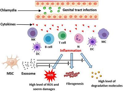 Mesenchymal Stem-Cell Derived Exosome Therapy as a Potential Future Approach for Treatment of Male Infertility Caused by Chlamydia Infection